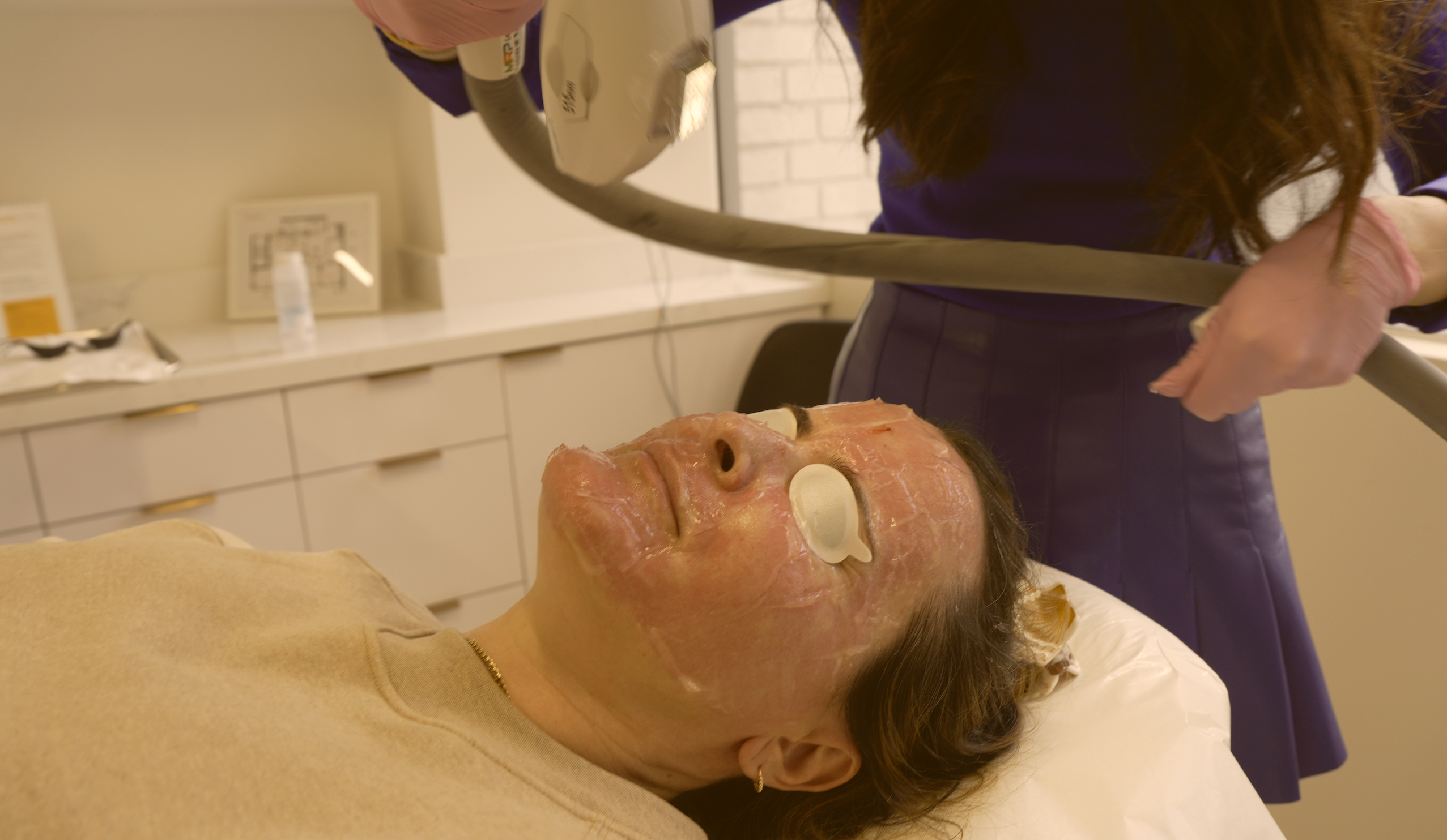 Broad-band light (BBL) photofacial